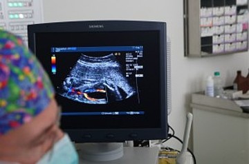 Ultraschallbild bei der Untersuchung