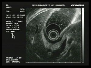 Endosonographie der Speiseröhre