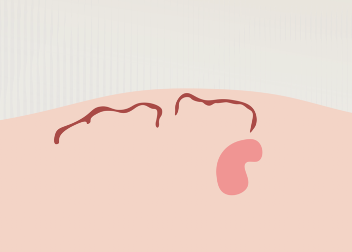 Ilustration 6