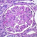 Nephropathologie