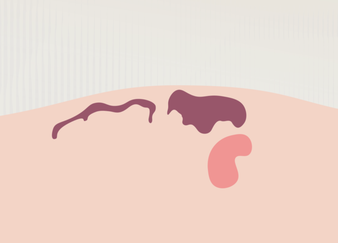 Ilustration 5