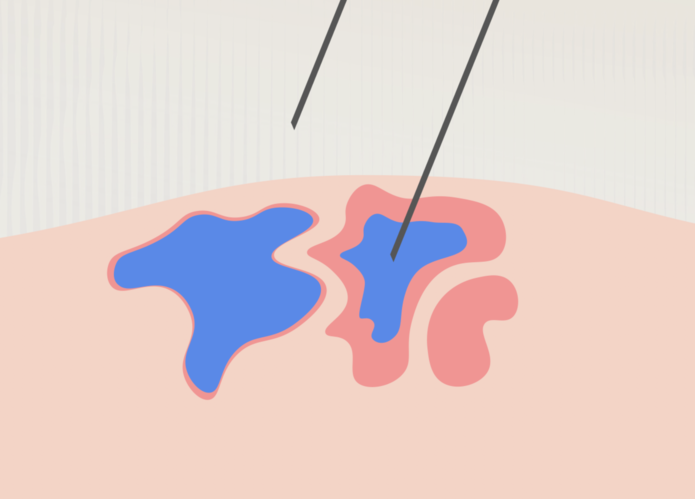 Ilustration 3