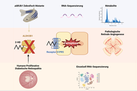 Hier ist eine Grafik zu sehen, die den Mechanismus abbildet, die der pathologischen Gefäßneubildung zugrundeliegt