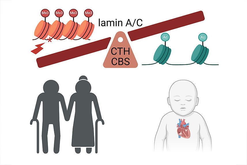 Hier ist eine Grafik zu sehen mit einer Waage, an der Lamina A/C den Ausschlag gibt, ob der zelluläre Stoffwechsel im Gleichgewicht ist oder nicht. Dies entscheidet über entweder Gesundheit, symbolisiert mit einem Säugling mit einem gesunden Herzen, oder Alterung, symboliert mit einem greisen Paar. 