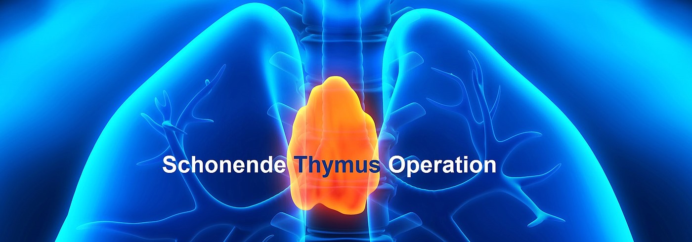 Thymus Operation
