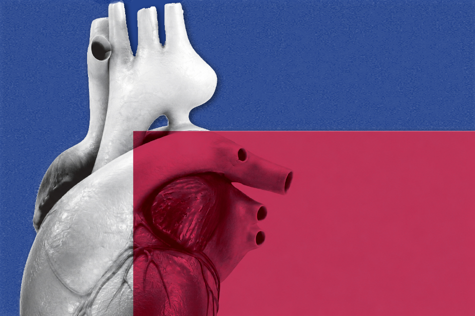 Anatomisches Modell eines menschlichen Herzens vor blauem Hintergrund mit rotem halbtransparentem Rechteck im Vordergrund