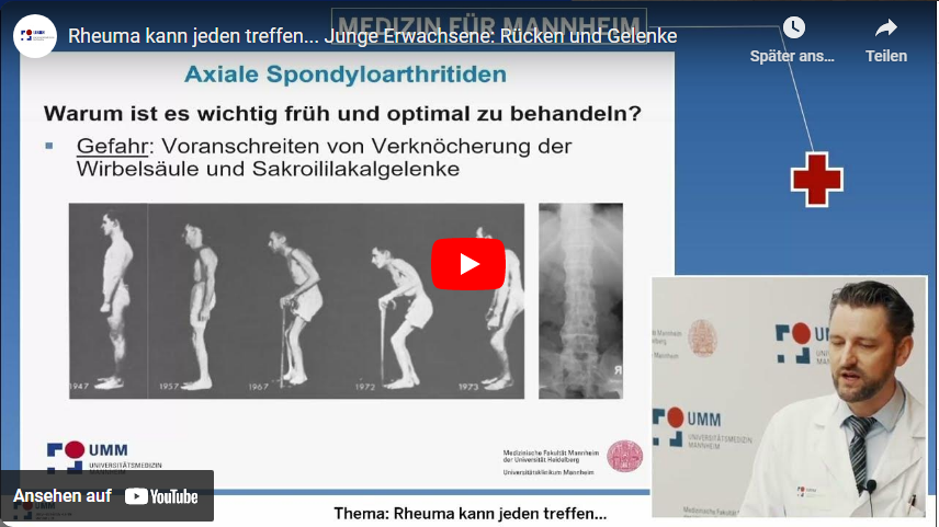 Vortrag von PD Dr. med. Jan Leipe, Sektionsleiter Rheumatologie der V. Medizinischen Klinik, bei der Veranstaltung "Rheuma kann jeden treffen..." in der Vortragsreihe "Medizin für Mannheim"